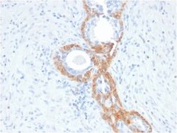 Cytokeratin, HMW Antibody (rKRTH/2148) - Azide and BSA Free, Novus Biologicals 100 &mu;g | Buy Online | Novus Biologicals | Fisher Scientific